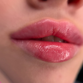 Ольга Шаня, Житомир Фото - 5