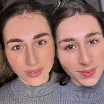 Лілія , Житомир Фото - 5