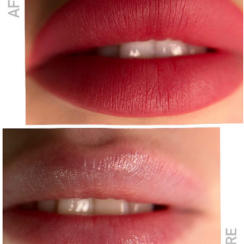 Инна Коваль, Черновцы Фото - 5