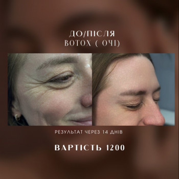 Вікторія Корсюк, Запоріжжя Фото - 8