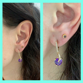 Прокол мочкі додатковий