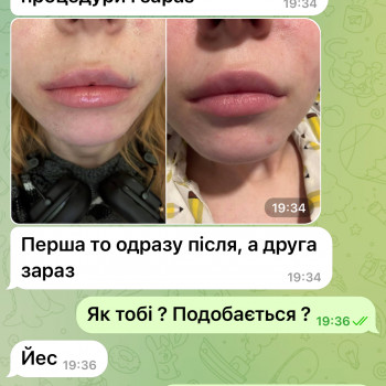 Лета Денисова, Киев Фото - 3