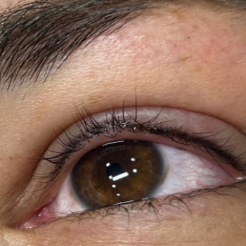 Альона , Чернівці Фото - 5