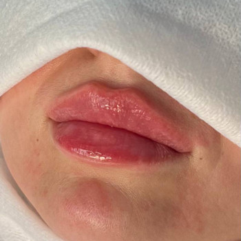 Іванна Корягіна, Тернопіль Фото - 6