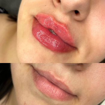 Іванна Корягіна, Тернопіль Фото - 7