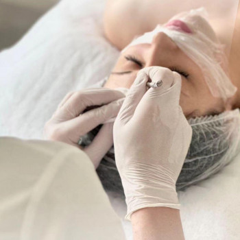 Чистка обличчя