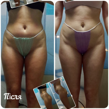 Юлія Шабленко, Тернопіль Фото - 26