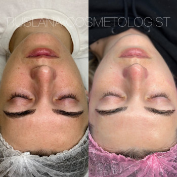 Руслана Хворостенко, Черкаси Фото - 1