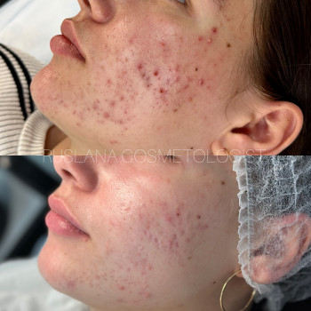 Руслана Хворостенко, Черкаси Фото - 2