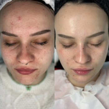 Руслана Хворостенко, Черкаси Фото - 3