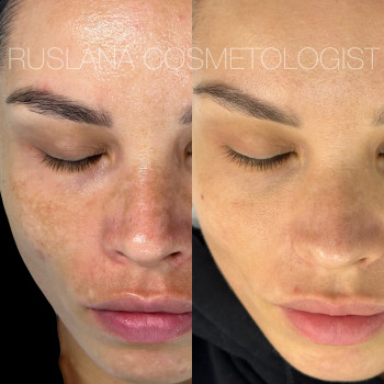 Руслана Хворостенко, Черкаси Фото - 4