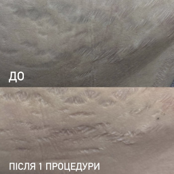 Фото з портфоліо майстра Тетяна Конюх (майстер перманентного макіяжу, Львів)