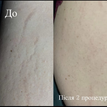 Фото з портфоліо майстра Тетяна Конюх (майстер перманентного макіяжу, Львів)