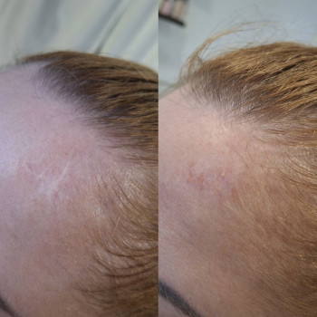 Фото з портфоліо майстра Тетяна Конюх (майстер перманентного макіяжу, Львів)