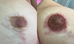 Татуаж ареол Майстер перманентного макіяжу  Київ