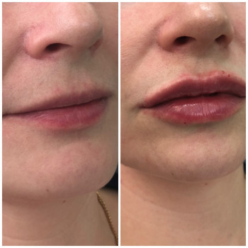 Валерия Коломиец , Сумы Фото - 6