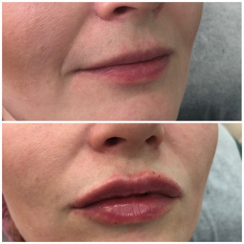 Валерия Коломиец , Сумы Фото - 7