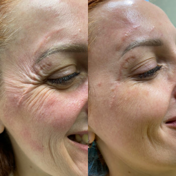 Валерия Коломиец , Сумы Фото - 8