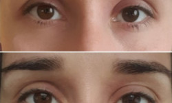 Класичний масаж обличчя Косметологічний центр WE Cosmetology Біла Церква