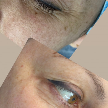 Олена Смульська, Хмельницький Фото - 1