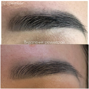 Видалення лазером
                    Майстер перманентного макіяжу Oksana Луцьк