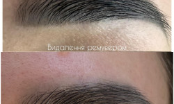 Видалення лазером Мастер перманентного макияжа Oksana Луцк