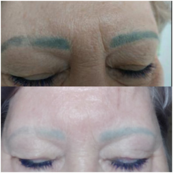 Видалення лазером
                    Майстер перманентного макіяжу Oksana Луцьк