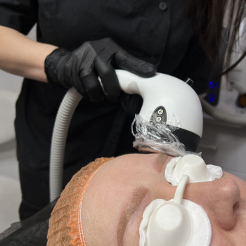 Видалення перманентного макіяжу
                    Косметолог-эстетист Ольга Чернигов