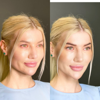 Олена Панченко, Київ Фото - 6