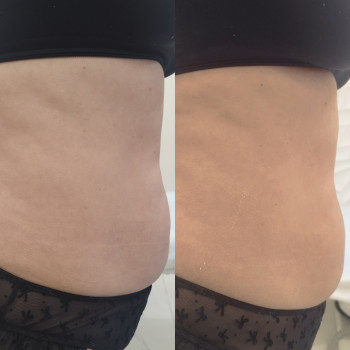 Альона Горбова, Ірпінь Фото - 6