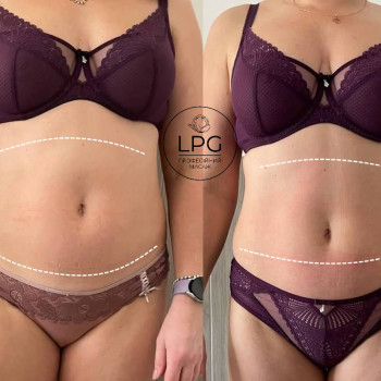 результати загального курсу