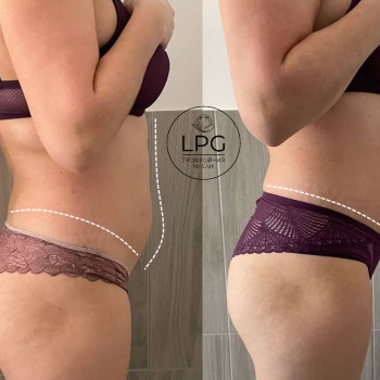 результати загального курсу