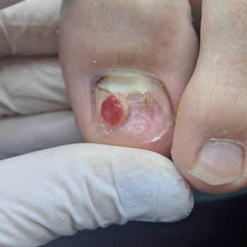 Ярина Кошик, Вишневе Фото - 10