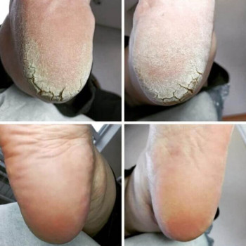 Ярина Кошик, Вишневе Фото - 11