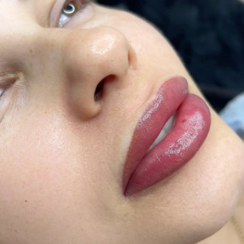 Наталья Котко, Днепр Фото - 5