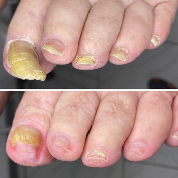 Наталья Балаховская, Кременчуг Фото - 45