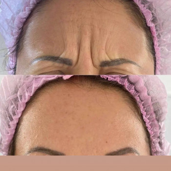 Ирина Ветох, Чернигов Фото - 5