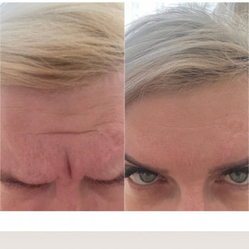 Ирина Ветох, Чернигов Фото - 7