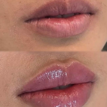 Ирина Ветох, Чернигов Фото - 10