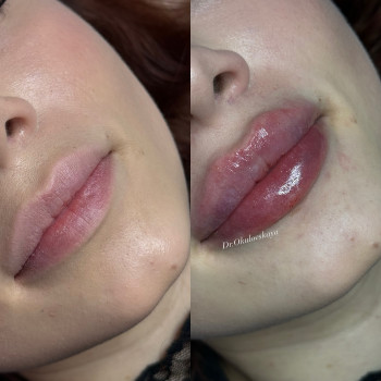 Наталья Окуловская, Київ Фото - 1