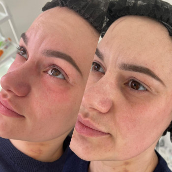 Лана Мащенко, Черновцы Фото - 13