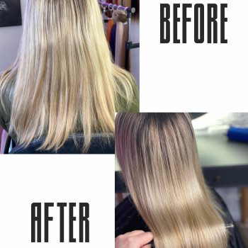 Озонотерапія 
          