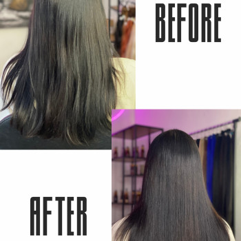 Озонотерапія 
          