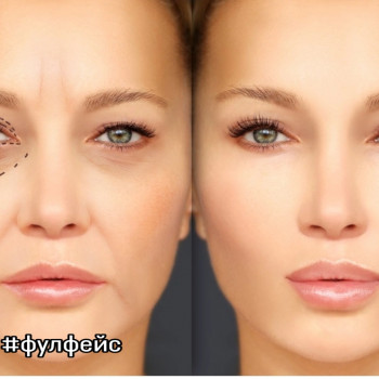 Ольга Штибіна-Єсепчук, Харків Фото - 5