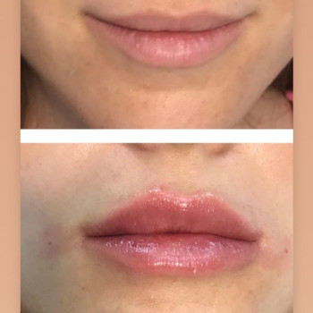 Евгения Ковтун, Киев Фото - 6