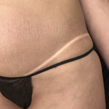 Олеся Рудченко, Вінниця Фото - 5