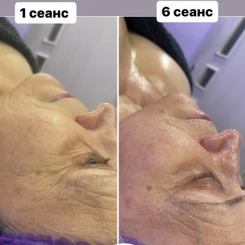 Массаж лица
                    Массажист Дарья Запорожье