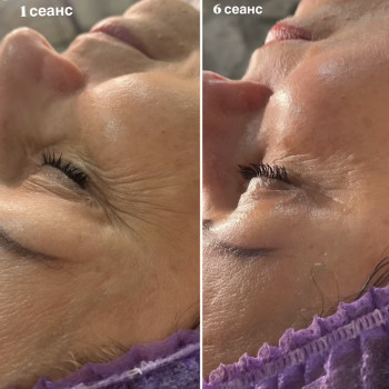 Массаж лица
                    Массажист Дарья Запорожье