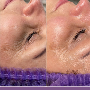 Массаж лица
                    Массажист Дарья Запорожье