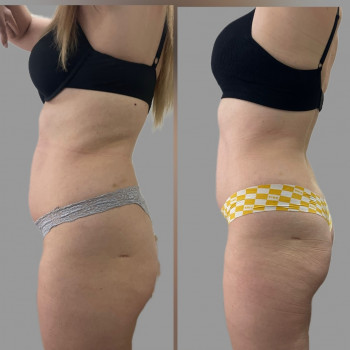 Юлия Ещенко, Киев Фото - 7